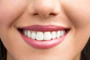 Lake Park Dental's Approach To Adult Orthodontics
